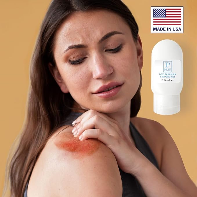 Burn Gel, Hydrogel Based Botanical Gel with Calendula, Chamomile & Aloe; Lightweight, Non-Greasy Formula for Minor Burn Skin Care - 2 oz / 60 ml, Made in USA