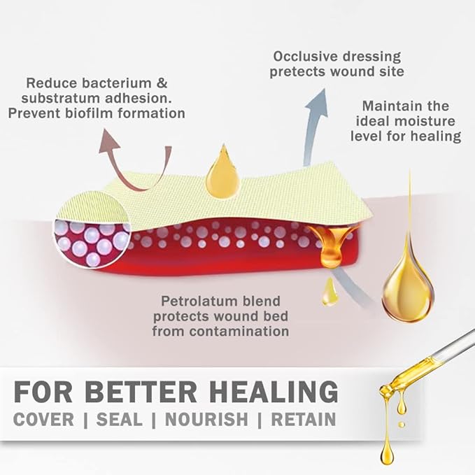 EVERLIT Xeroform Petrolatum Dressing | Sterile, Non-Adherent Occlusive Fine Mesh Gauze Pad | Non-Toxic, Gentle Patch for Burns, Laceration, Surgical Incisions & Skin Grafts (5" x 9" | Pack of 25)