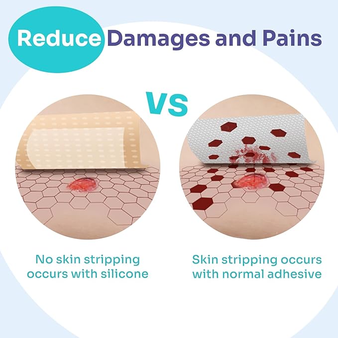 Conkote Silicone Foam Dressings 4'' X 4'', Large Bandages for Bedsores, Wound Care, Box of 5 Dressings