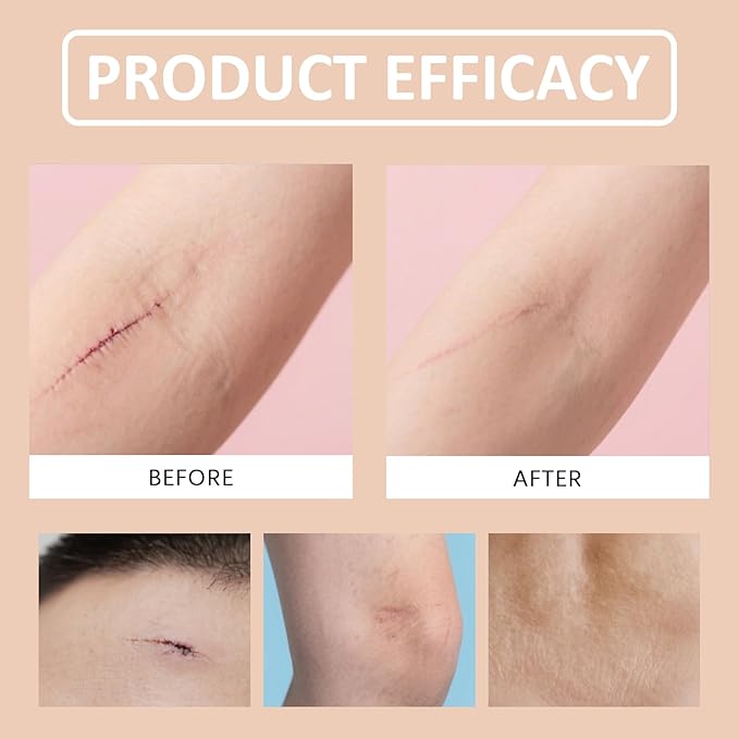 Silicone Scar Stick (2-Pack) - Helps Improve the Appearance of Old & New Scars on Face & Body, For Use After C-Section, Surgery, Acne, Burns - Non-Greasy, Easy-to-Use