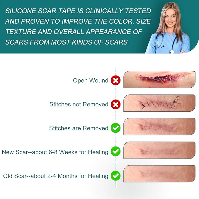 Silicone Scar Sheets (1.6"x 158" Roll-4M), Silicone Scar Tape for Scar Removal Treatment, Reusable Silicone Scar Strips for C-Section, Keloid, Burn, Acne, Surgical Scars