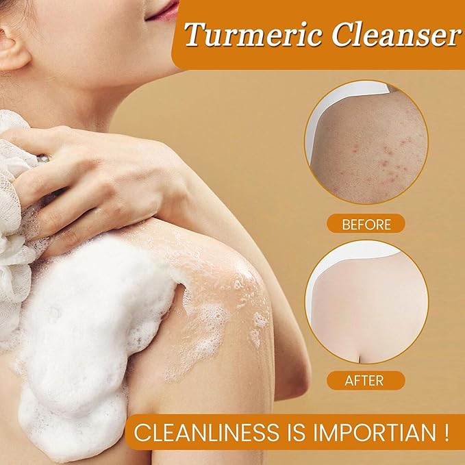 Turmeric Wash and Care 4 Piece Set - Lemon Turmeric Kojic Soap Bar & Cleansing Pads & Face Wash & Essential Oil, Jabon de Curcuma, Deep Cleansing Exfoliating Scrub Pads for Face & Body (A)