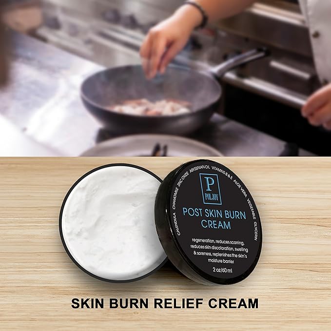 Post Skin Burn Cream, Sunburn Cream for First Aid Treatment, Hydrates & Repairs Skin with Aloe Vera, Shea Butter, Zinc Oxide, Calendula, Coconut Oil & Vitamins B&E, Kitchen & Travel Use