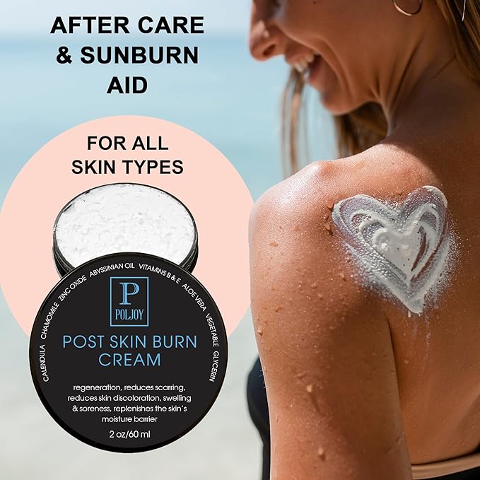 Post Skin Burn Cream, Sunburn Cream for First Aid Treatment, Hydrates & Repairs Skin with Aloe Vera, Shea Butter, Zinc Oxide, Calendula, Coconut Oil & Vitamins B&E, Kitchen & Travel Use