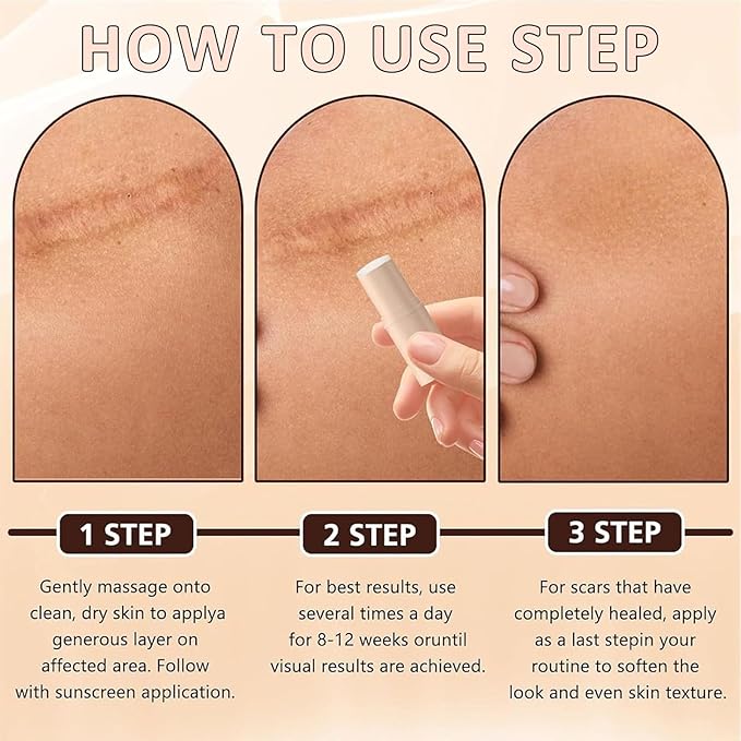 Silicone Scar Stick (2-Pack) - Helps Improve the Appearance of Old & New Scars on Face & Body, For Use After C-Section, Surgery, Acne, Burns - Non-Greasy, Easy-to-Use