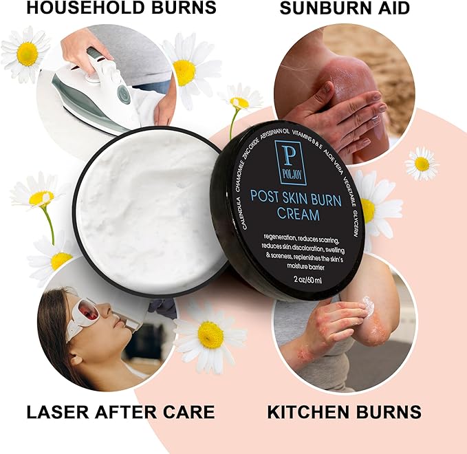 Post Skin Burn Cream, Sunburn Cream for First Aid Treatment, Hydrates & Repairs Skin with Aloe Vera, Shea Butter, Zinc Oxide, Calendula, Coconut Oil & Vitamins B&E, Kitchen & Travel Use
