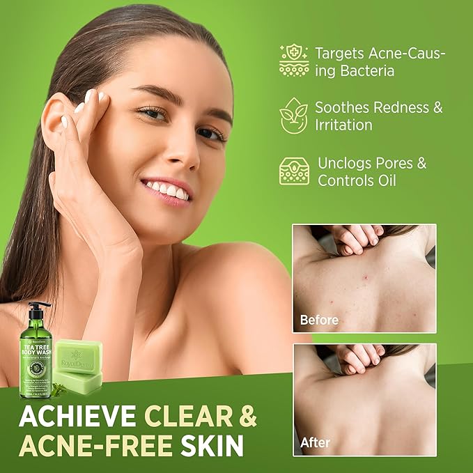 Roycederm Tea Tree Antifungal Body Wash & Soap: Bundle for Body Odor, Back Acne, Folliculitis, Tinea Versicolor, Jock Itch, Athlete’s Foot, and Ringworm - Cleansing with tea tree oil for Men & Women