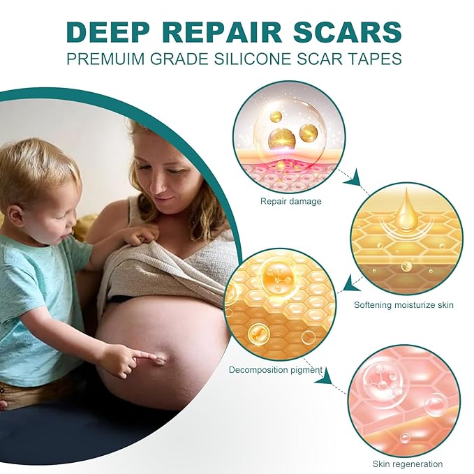 Silicone Scar Sheets (1.6"x 158" Roll-4M), Silicone Scar Tape for Scar Removal Treatment, Reusable Silicone Scar Strips for C-Section, Keloid, Burn, Acne, Surgical Scars