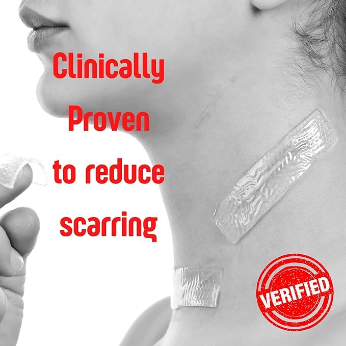 SilverSeal Burn and Wound Dressing | Hydrogel Pads with X-Static Silver | Soothing, Moist & Protective | Burns, Cuts & Wounds | 4 Sterile Dressings