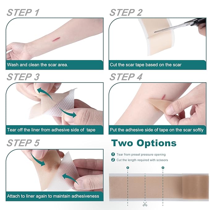 Silicone Scar Sheets (1.6"x 158" Roll-4M), Silicone Scar Tape for Scar Removal Treatment, Reusable Silicone Scar Strips for C-Section, Keloid, Burn, Acne, Surgical Scars