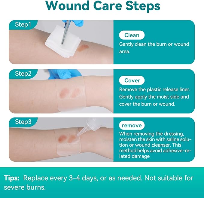Dimora Hydrogel Wound Dressing 1.7" x3" - Burn Pads Sterile Soothing Bandage, Cooling Protective Treatment for Minor Burns & Blisters, Cuts, Abrasions,Cracked Nipples, 10 Count