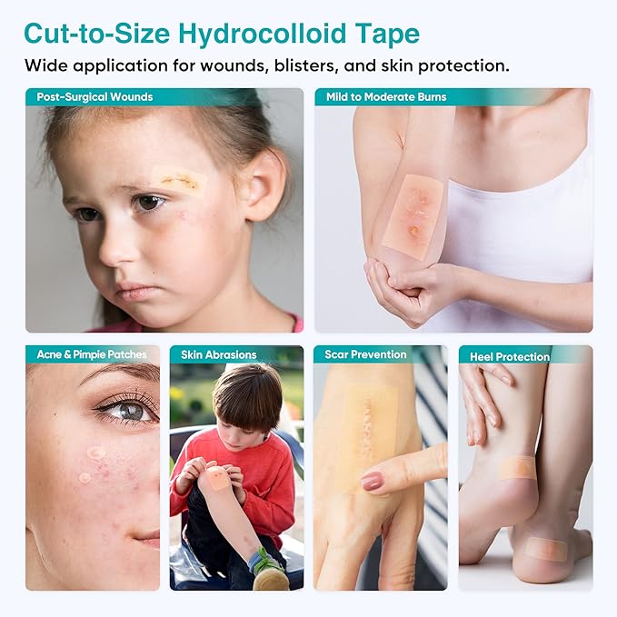 Derm Tape Hydrocolloid Roll - Acne & Pimple Patch Tape, Flexible Bandages Roll for Wound Care and Skin Protection, Cut-to-Size Hydrocolloid Tape for Daily Use (2in x 16ft)