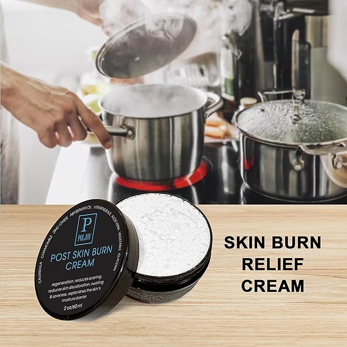 Post Skin Burn Cream, Sunburn Cream for First Aid Treatment, Hydrates & Repairs Skin with Aloe Vera, Shea Butter, Zinc Oxide, Calendula, Coconut Oil & Vitamins B&E, Kitchen & Travel Use